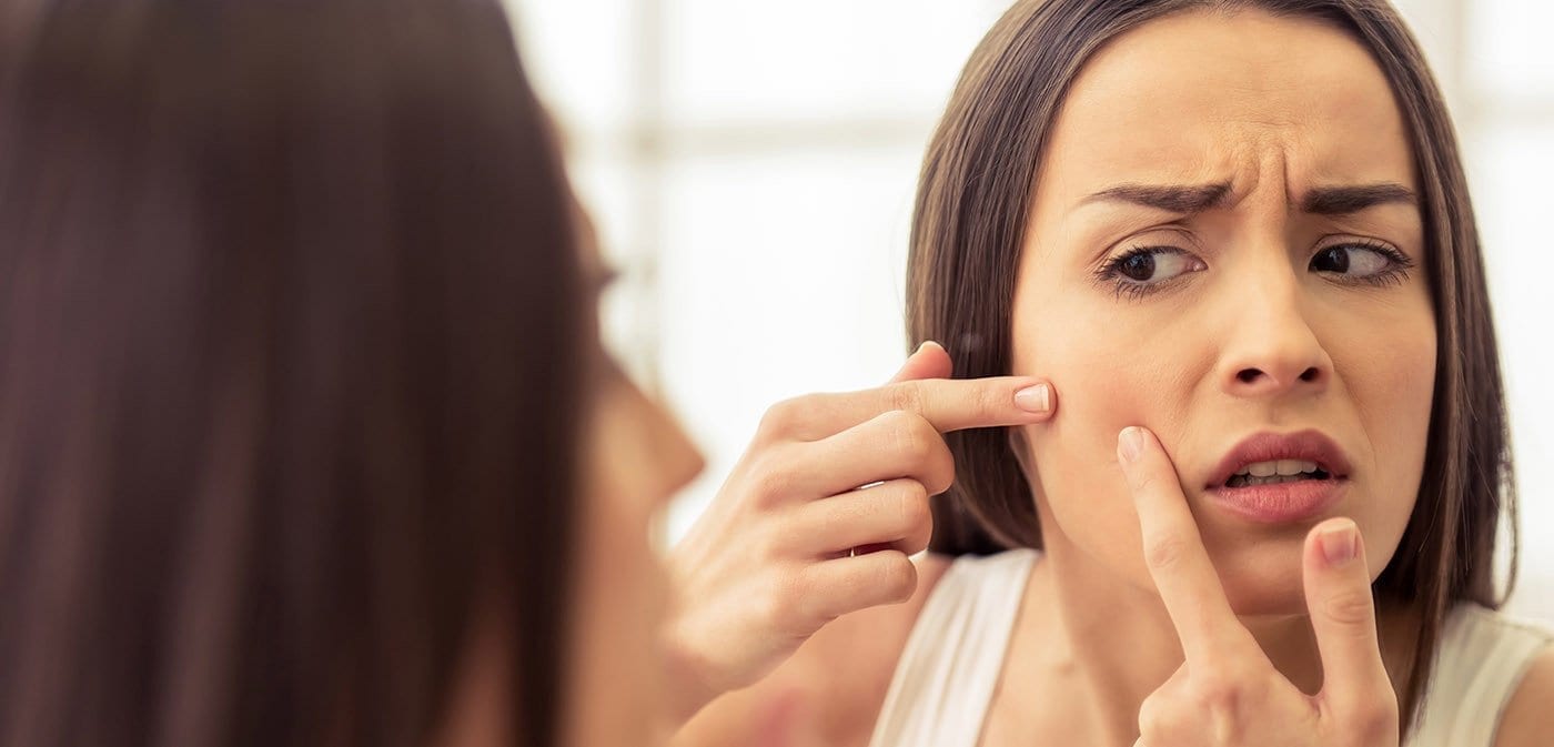 Combat Acne with these 5 Essential Tips