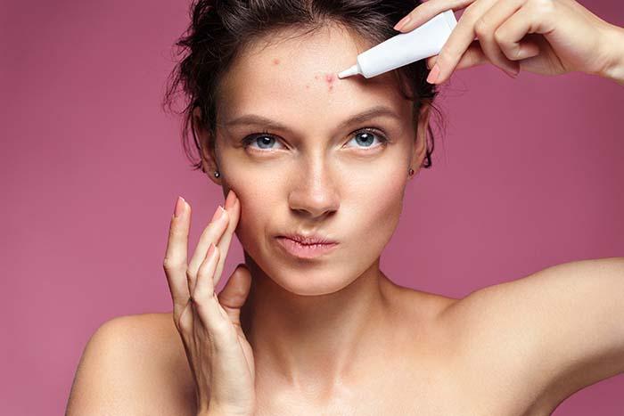 How to Hide Your Acne Without a Trace